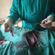 Visit to Wabane: A case of Strangulated Inguinal Hernia in Wabane