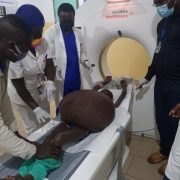 Visit to Wabane: A Child With Massive Ascites In Wabane